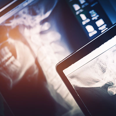 Digital imaging and x-rays at Inspire Chiropractic